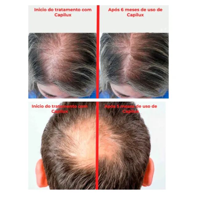 PROMOÇÃO CAPILUX -  Sérum Fortalecedor para Cabelos, Barba, Bigode e Sobrancelhas - Foto 2