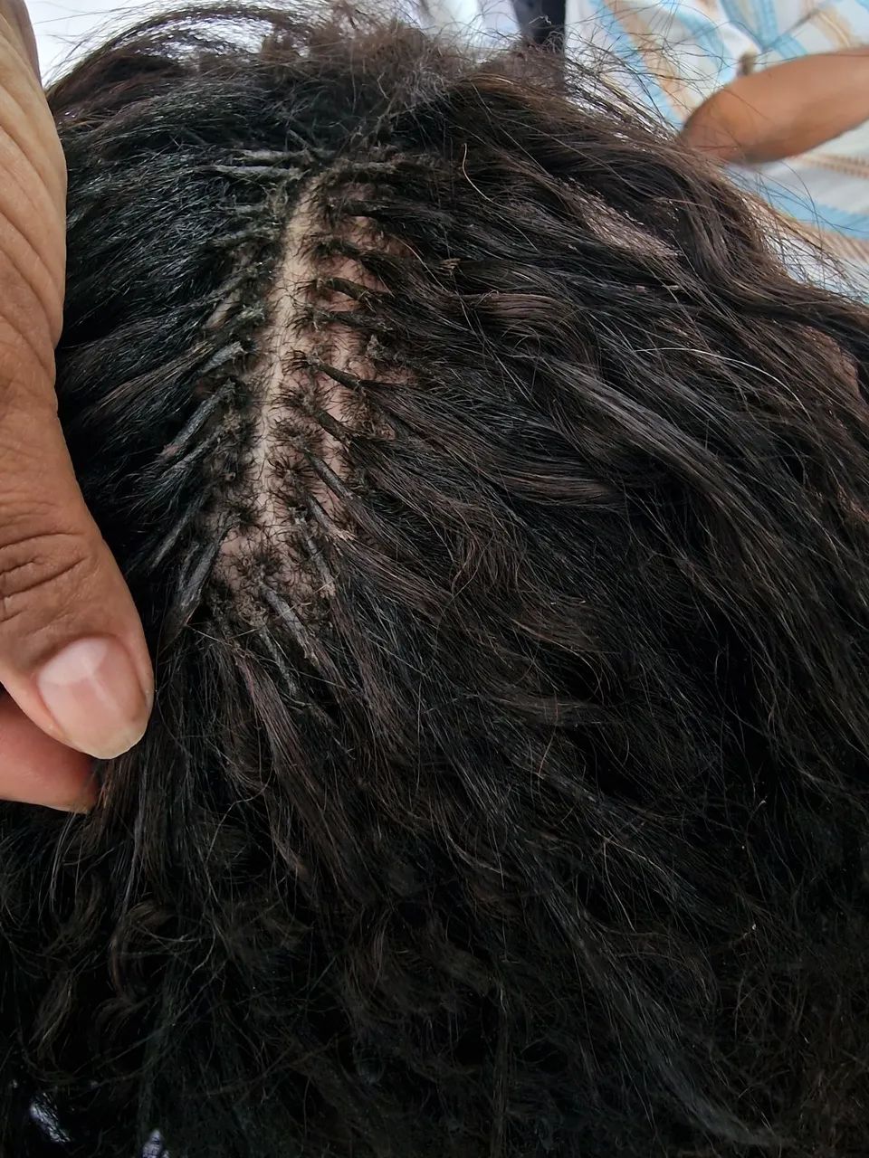 Colocação Megahair - Foto 2