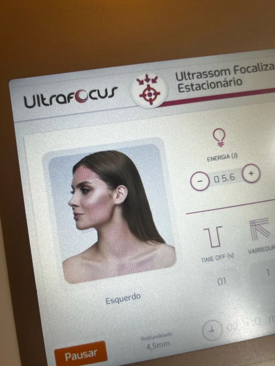Ultrafocus- ultrassom micro e macrofocado da HTM