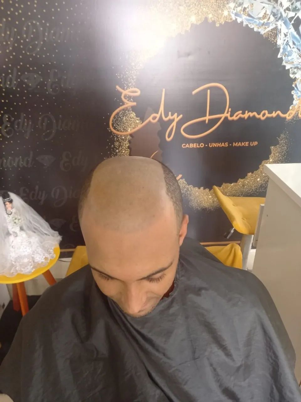 Prótese Capilar masculina  - Foto 3