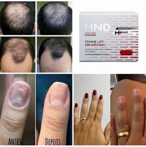 Fortalecedor de unhas e cabelos