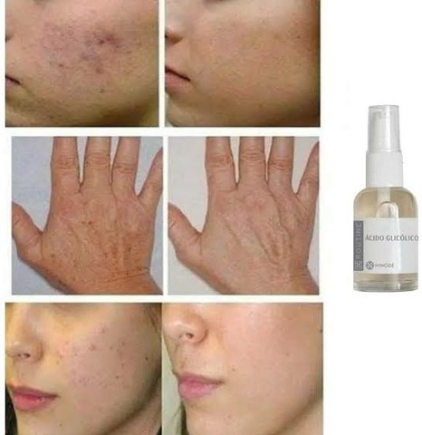 Acido Glicolico -Hinode  - Foto 3