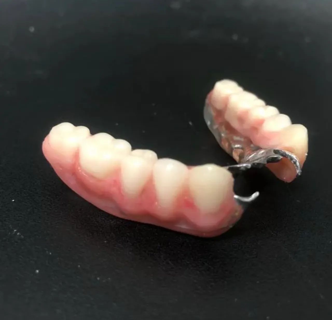 Prótese dentária a partir de 200 reais  - Foto 2