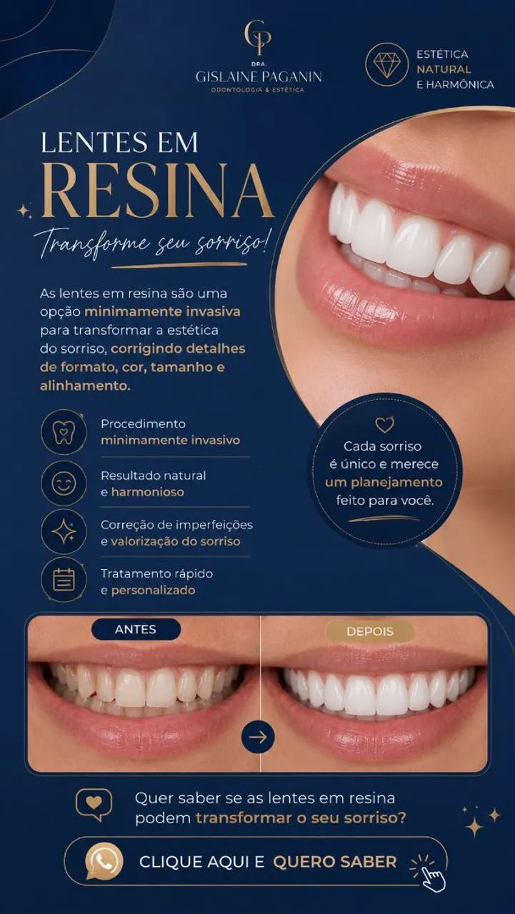 Lentes em resina | Transforme seu sorriso - Foto 2