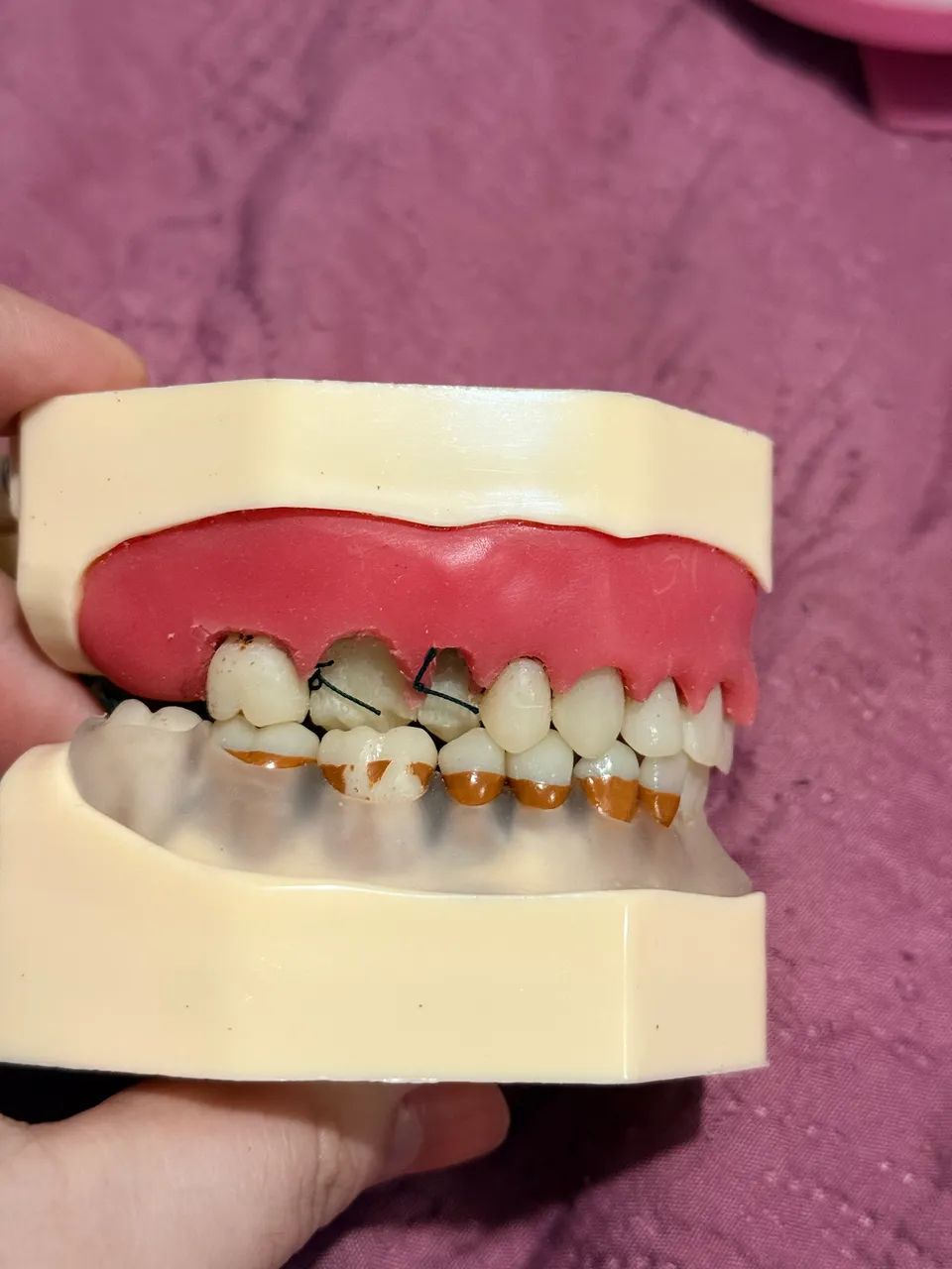 MANEQUIM ORAIS PERIODONTIA - Foto 2