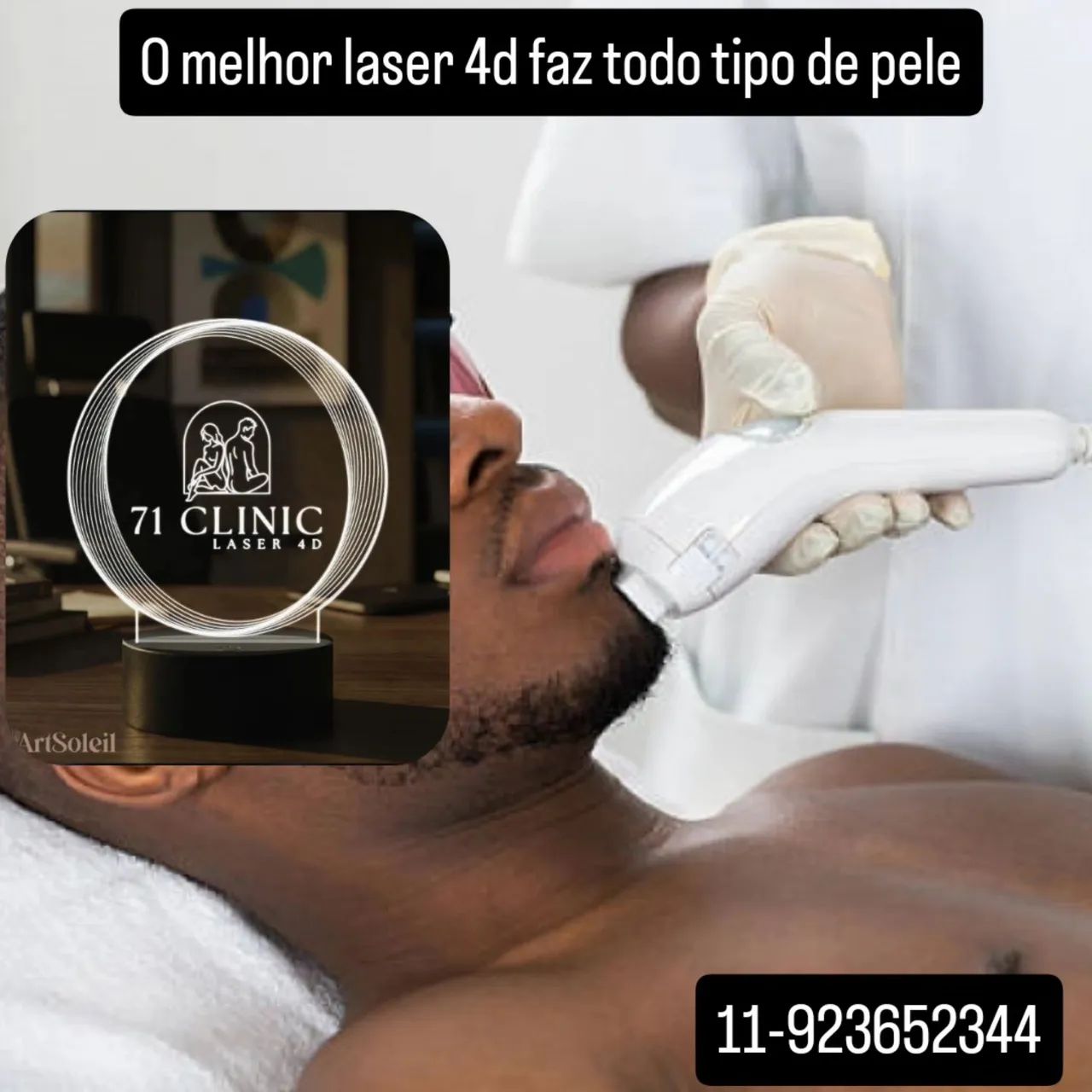 Depilação a laser 4D definitiva  - Foto 4