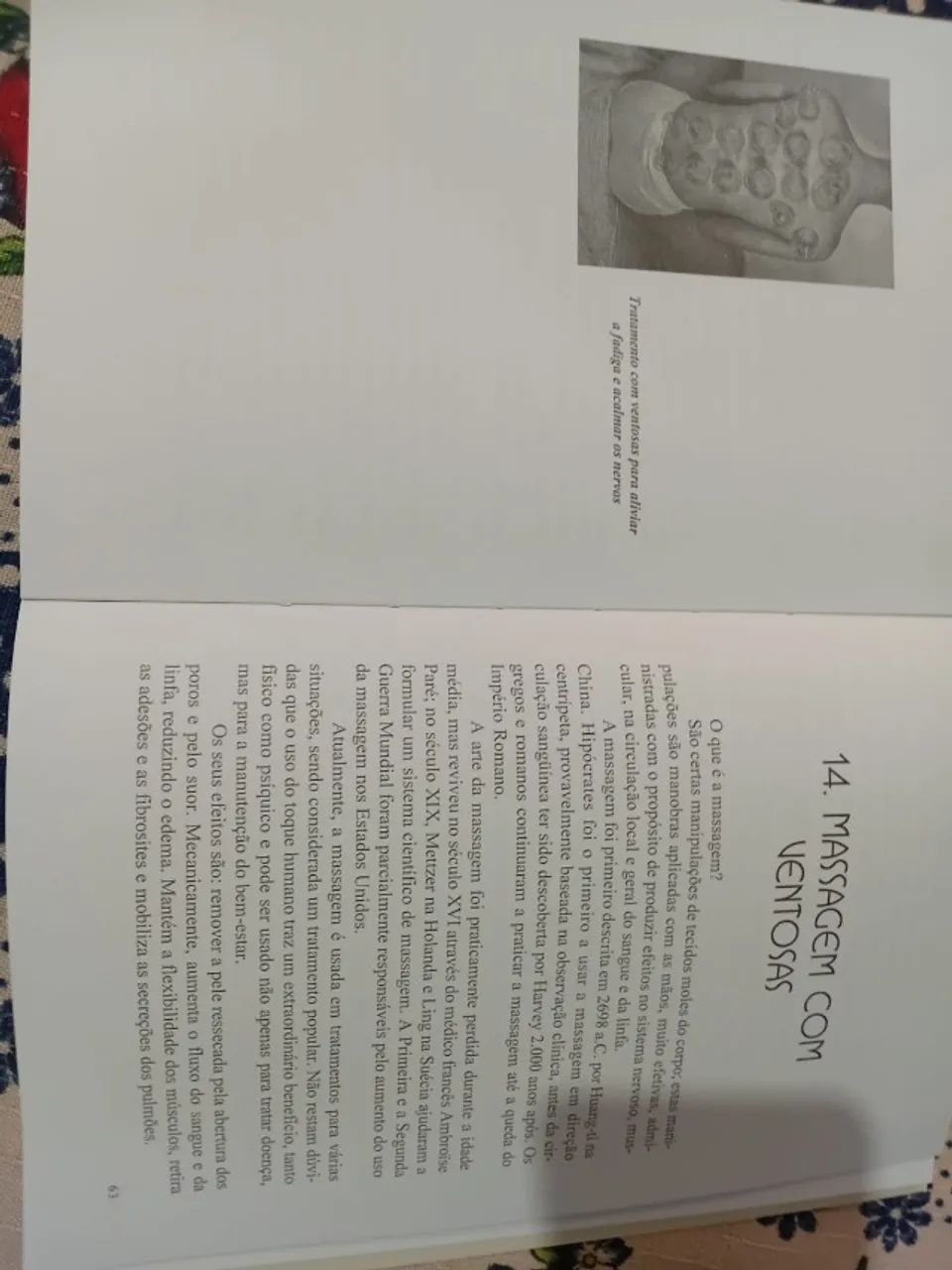 Livro Ventosaterapia - Foto 2