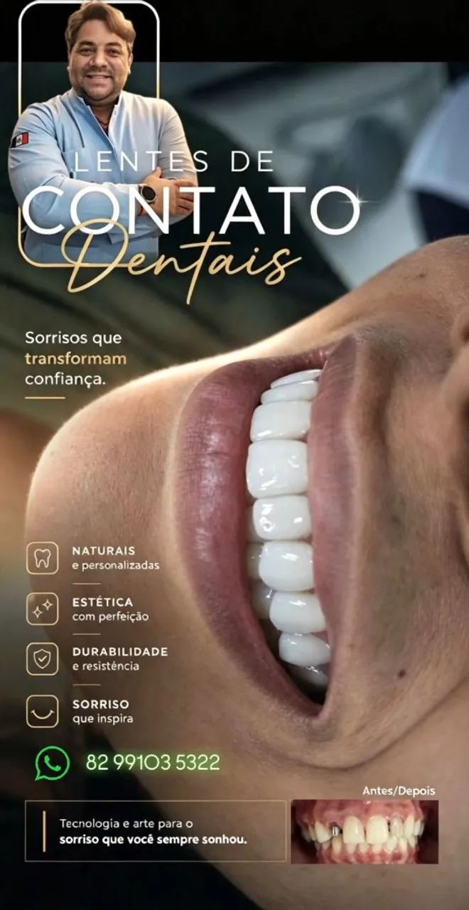 ? PERDEU UM DENTE? PODE SER HORA DE RESOLVER ISSO!