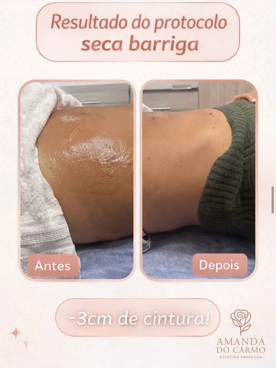 Estética avançada  - Foto 4