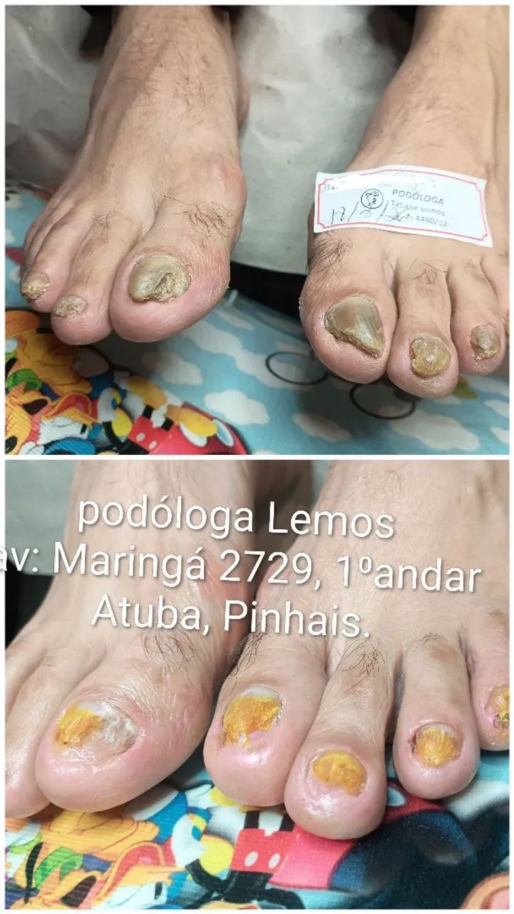 Podóloga em Pinhais  - Foto 3