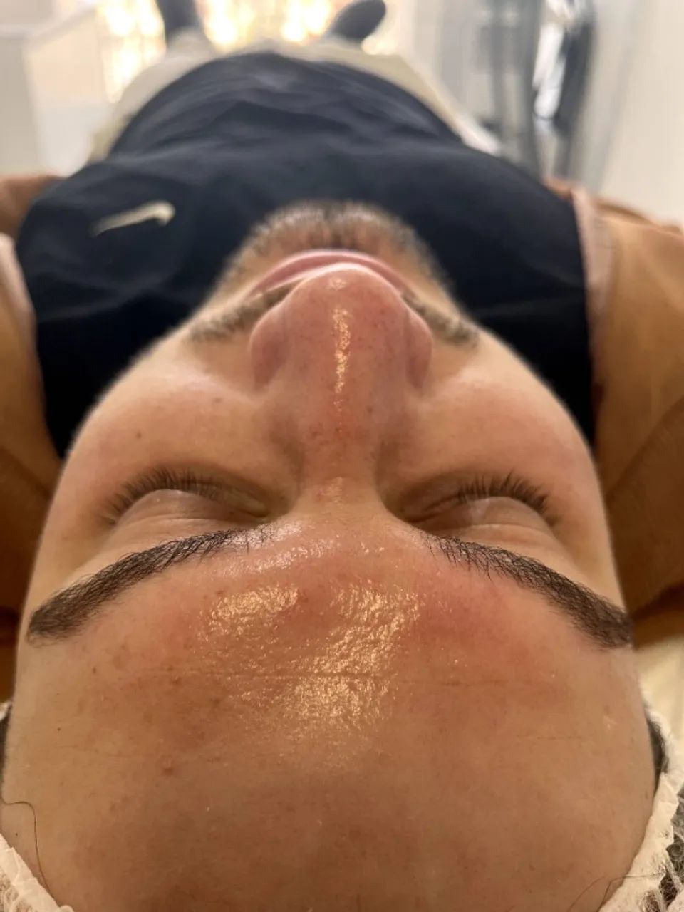 Limpeza de Pele Profissional |Peeling | Microagulhamento| Atendimento em Guarulhos - Foto 2