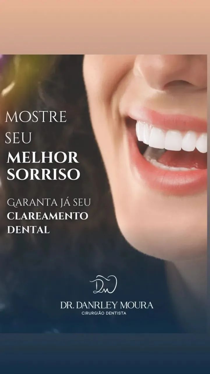Clareamento dental 