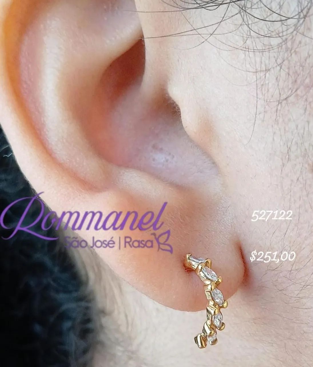 Agolas Rommanel  - Foto 3