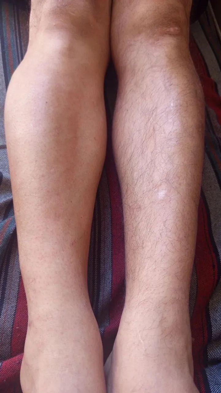 Depila ção com Cera Quente  - Foto 2