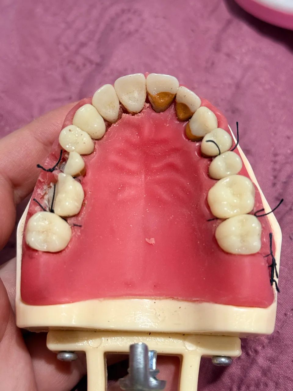 MANEQUIM ORAIS PERIODONTIA - Foto 3