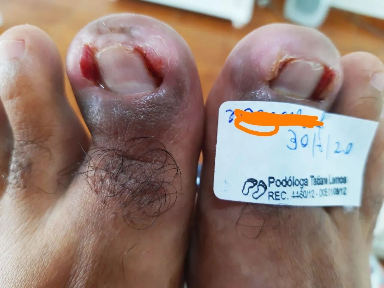 Podóloga em Pinhais  - Foto 4