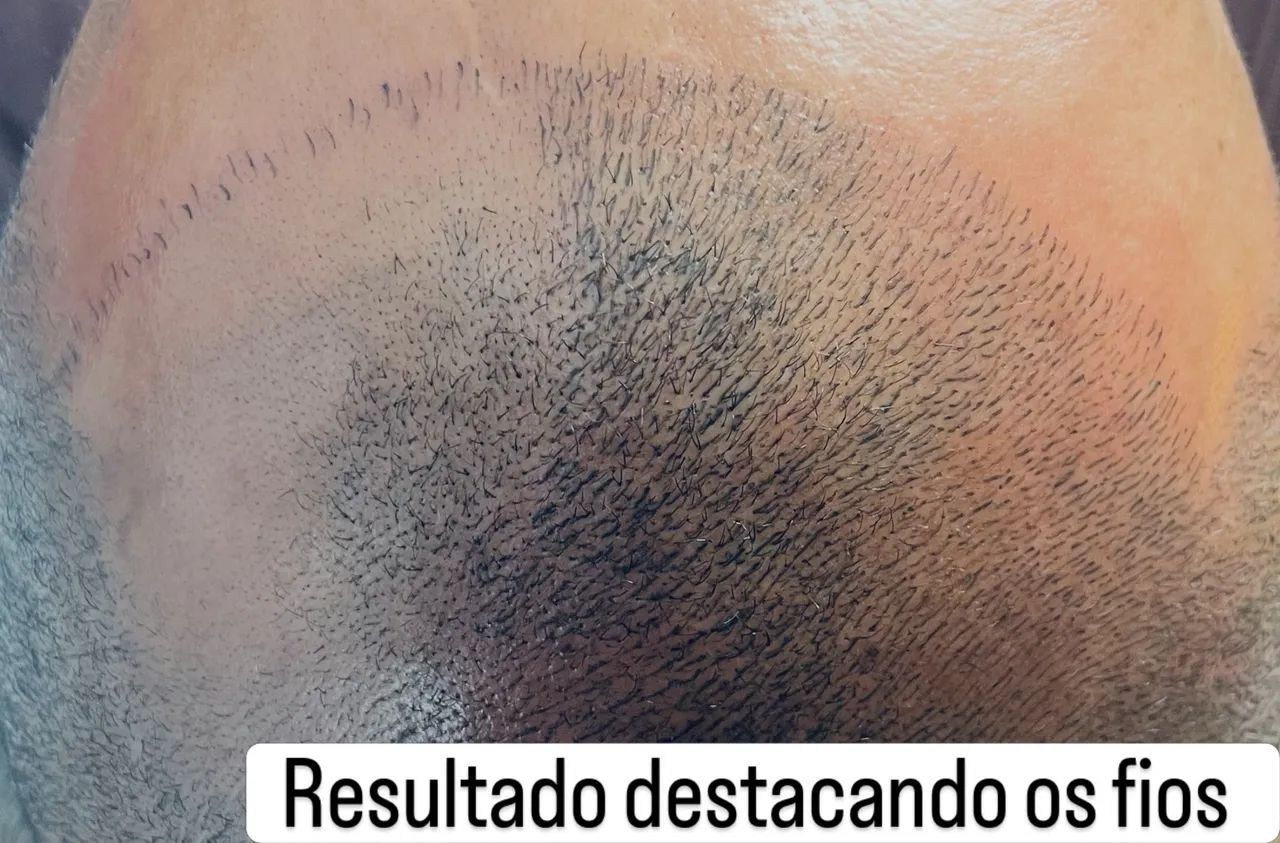 Fios 4D realista  micropigmentação capilar 499,00   - Foto 2