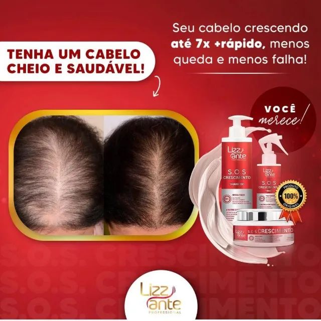 S.O.S CRESCIMENTO DE CABELO - Foto 2