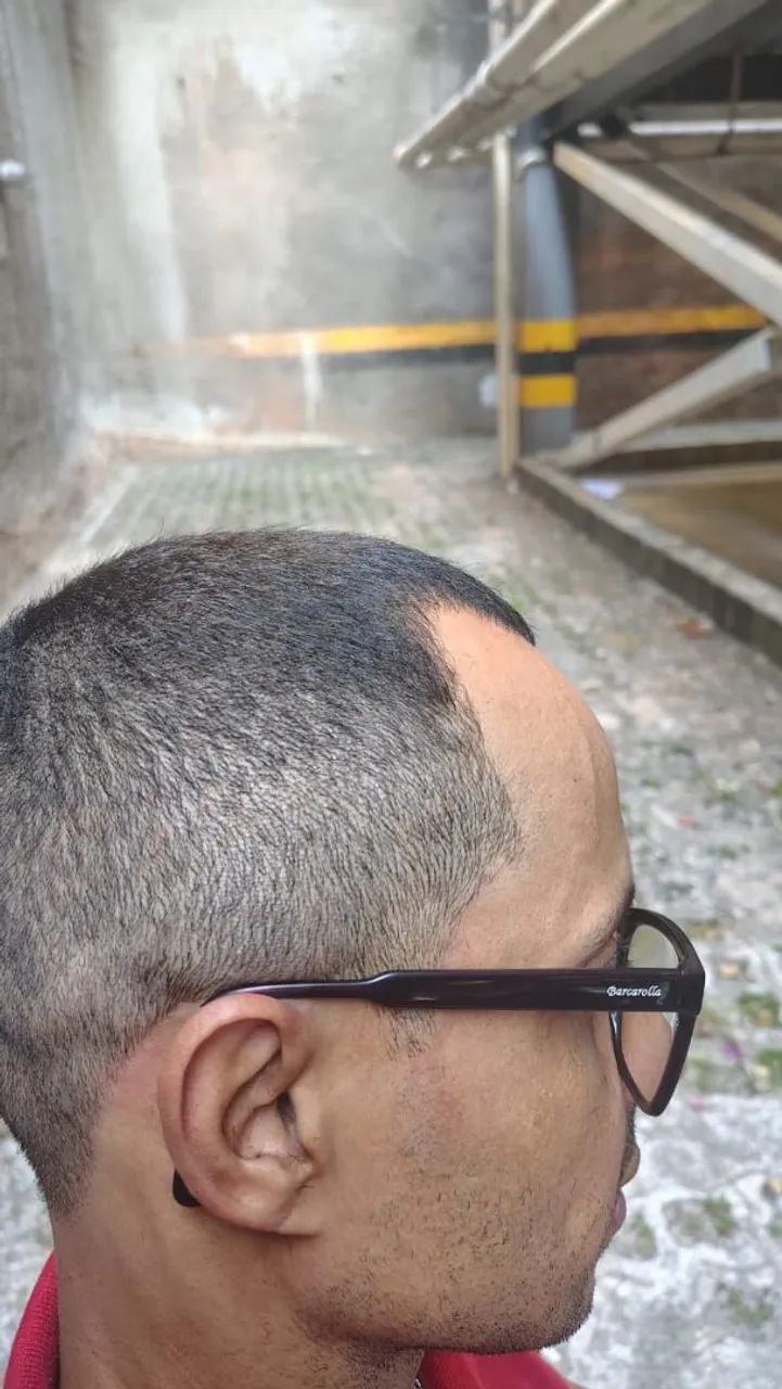 Corte de Cabelo Masculino ? - Foto 2