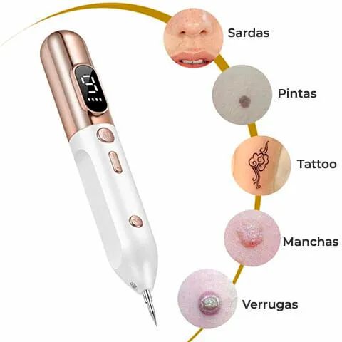 Caneta de jato de plasma com luz led e 9 níveis de potência  - Foto 2
