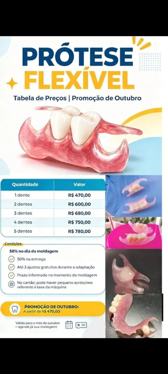Prótese dentária 