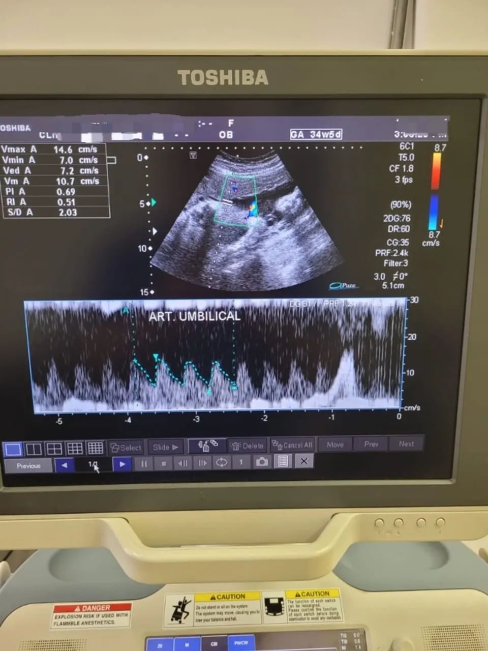 Aparelho de Ultrassom Toshiba Xario XG - Foto 3