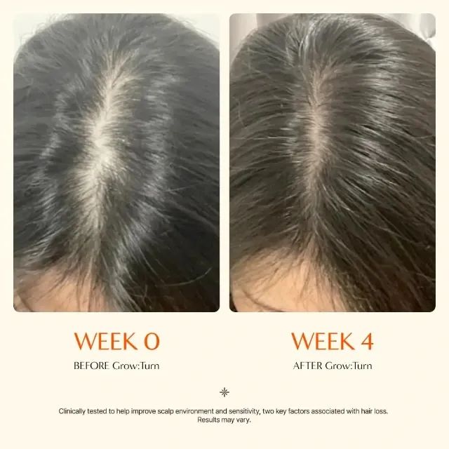 Grown Turn Ampoule Lilyeve Tratamento Capilar Coreano - Foto 3
