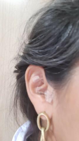 Acupuntura em Domicílio - Foto 5