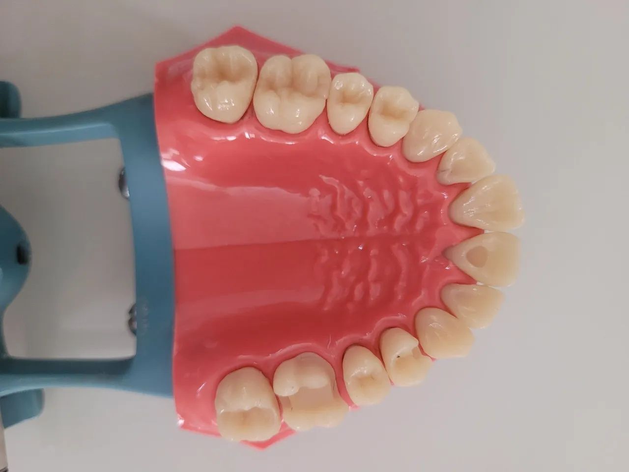 Manequim P- Oclusal de dentística  - Foto 3