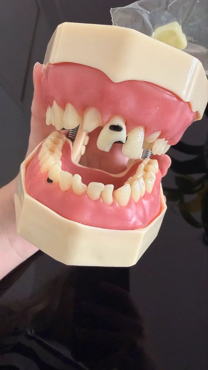 Manequim Orais (materiais dentários) - Foto 4