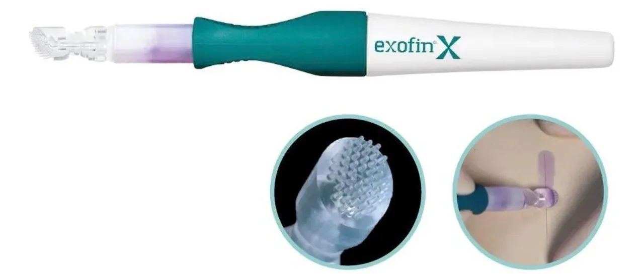 Kit Adesivo Cirurgico Caneta Exofin Pen 1ml +60cm Steristrip - Foto 2