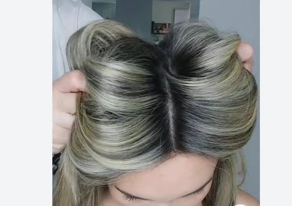 Atendimento em domicílio, artemísia Feitosa  - Foto 5