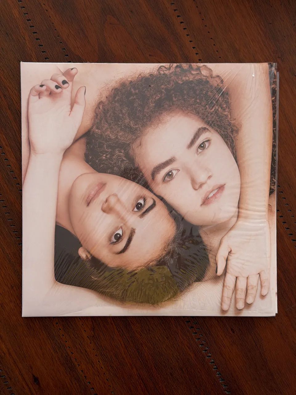Bundle LP Anavitoria  - Foto 2