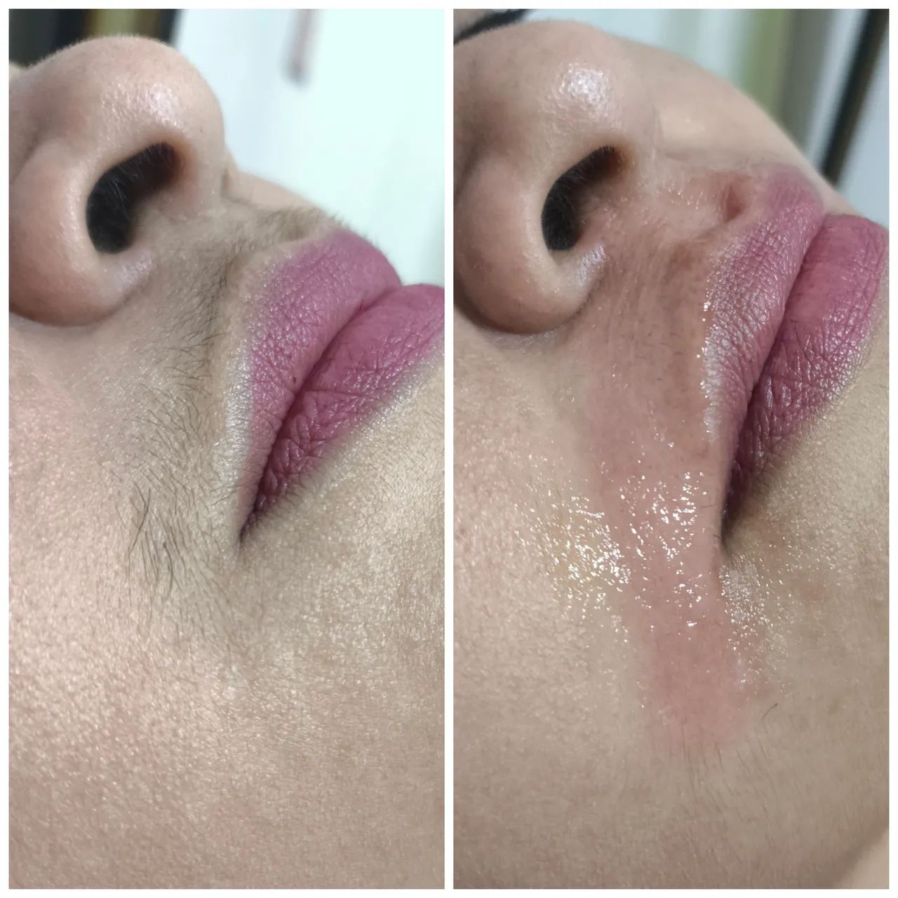 Depilação com cera  - Foto 4