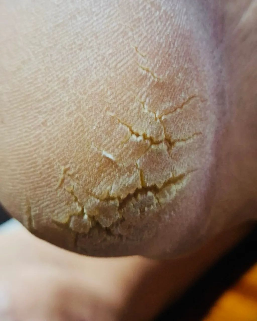 Manicure a domicílio  - Foto 4