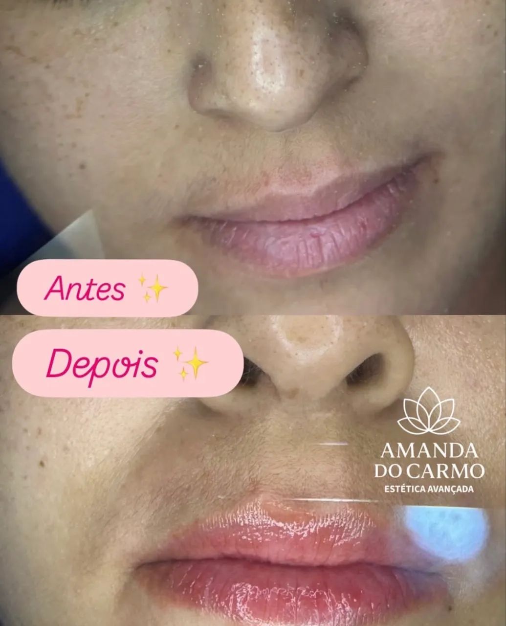 Estética avançada  - Foto 5