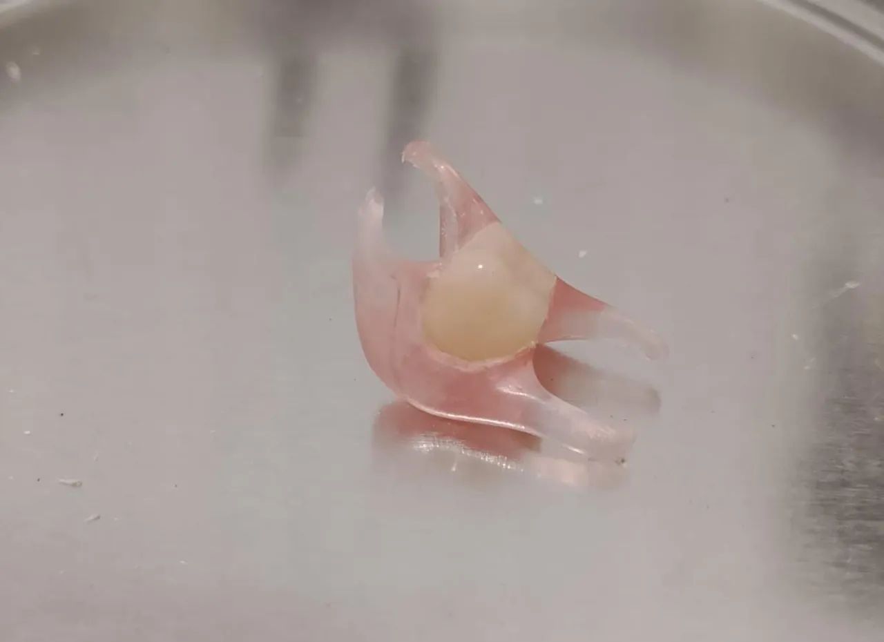 Prótese dentária  - Foto 2