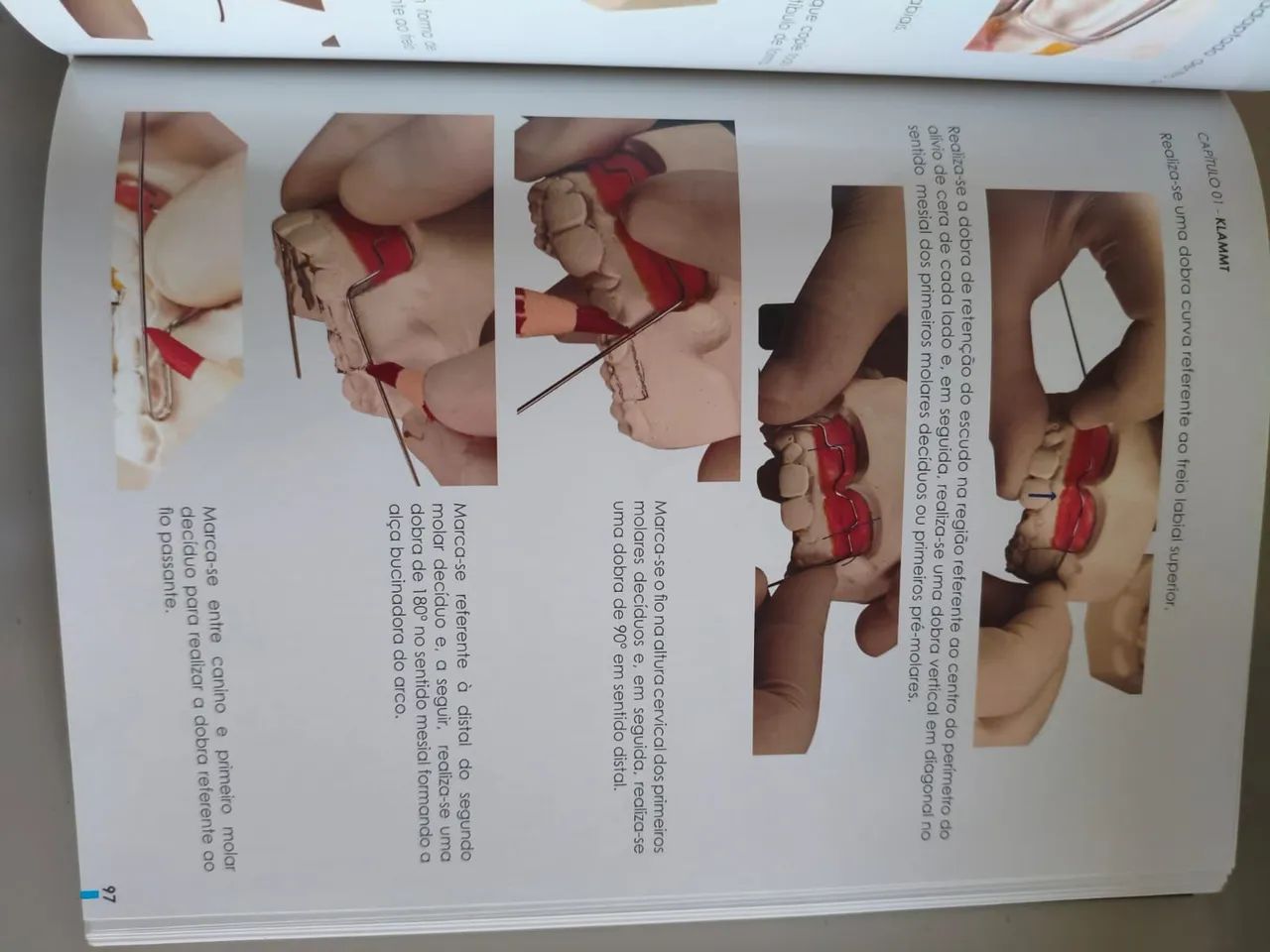 Livros ortodonticos - Foto 3
