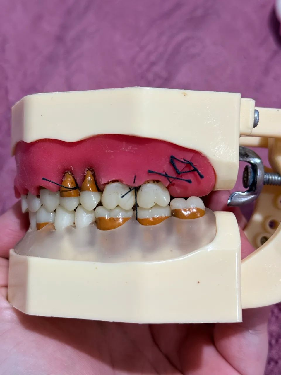 MANEQUIM ORAIS PERIODONTIA - Foto 5