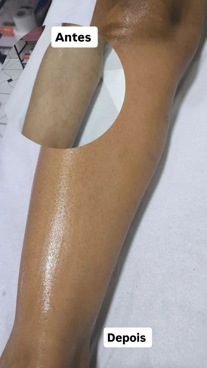 Depilação com cera  - Foto 5