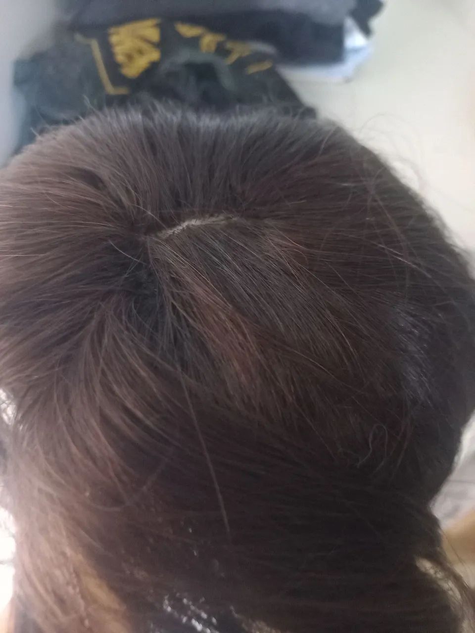 Topo capilar 