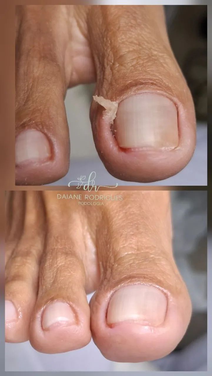 Serviço de podologia domiciliar e clínica  - Foto 2