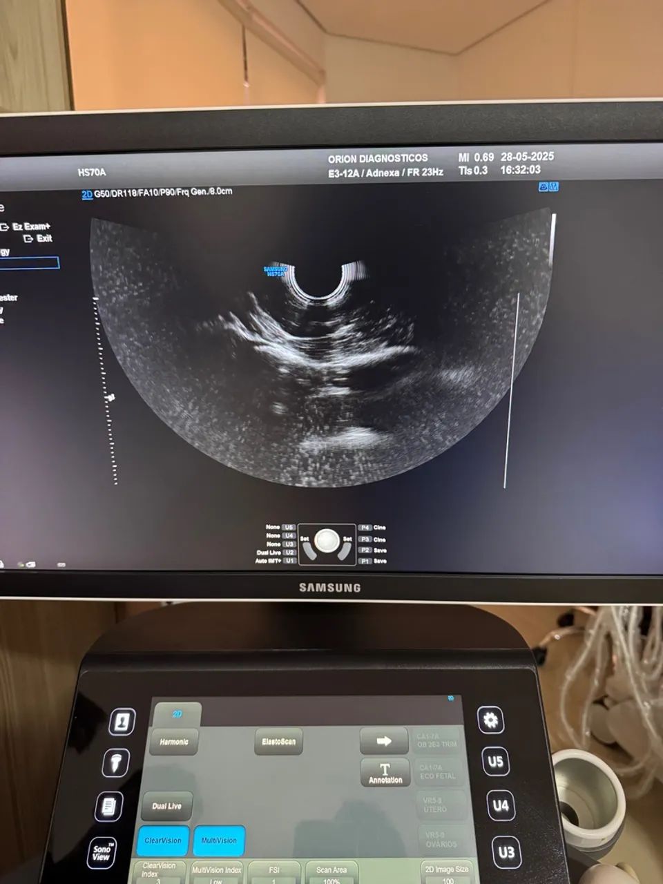Transdutor para ultrassom SAMSUNG endocavitario E3-12A - Foto 5