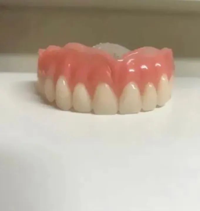 Prótese dentárias a partir de 200 reais  - Foto 5
