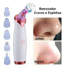 Removedor de Cravos e Espinhas - Compre 1 leve 2 Entrega em até 24h!