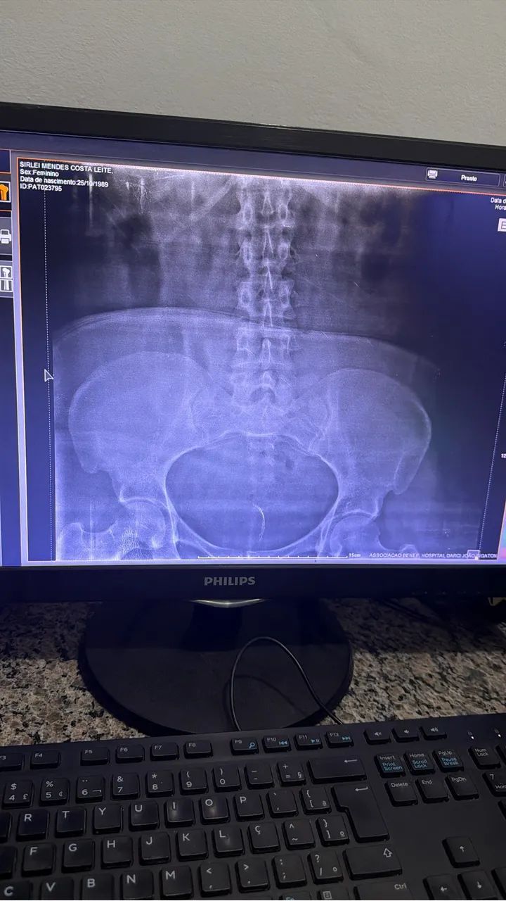 BULLDOG FRANCÊS  - Foto 4