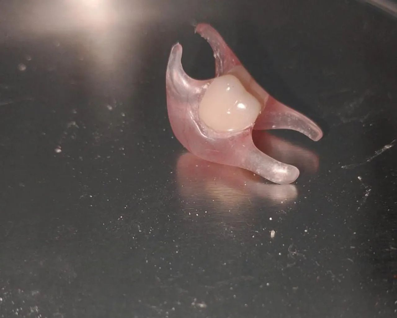 Prótese dentária  - Foto 3