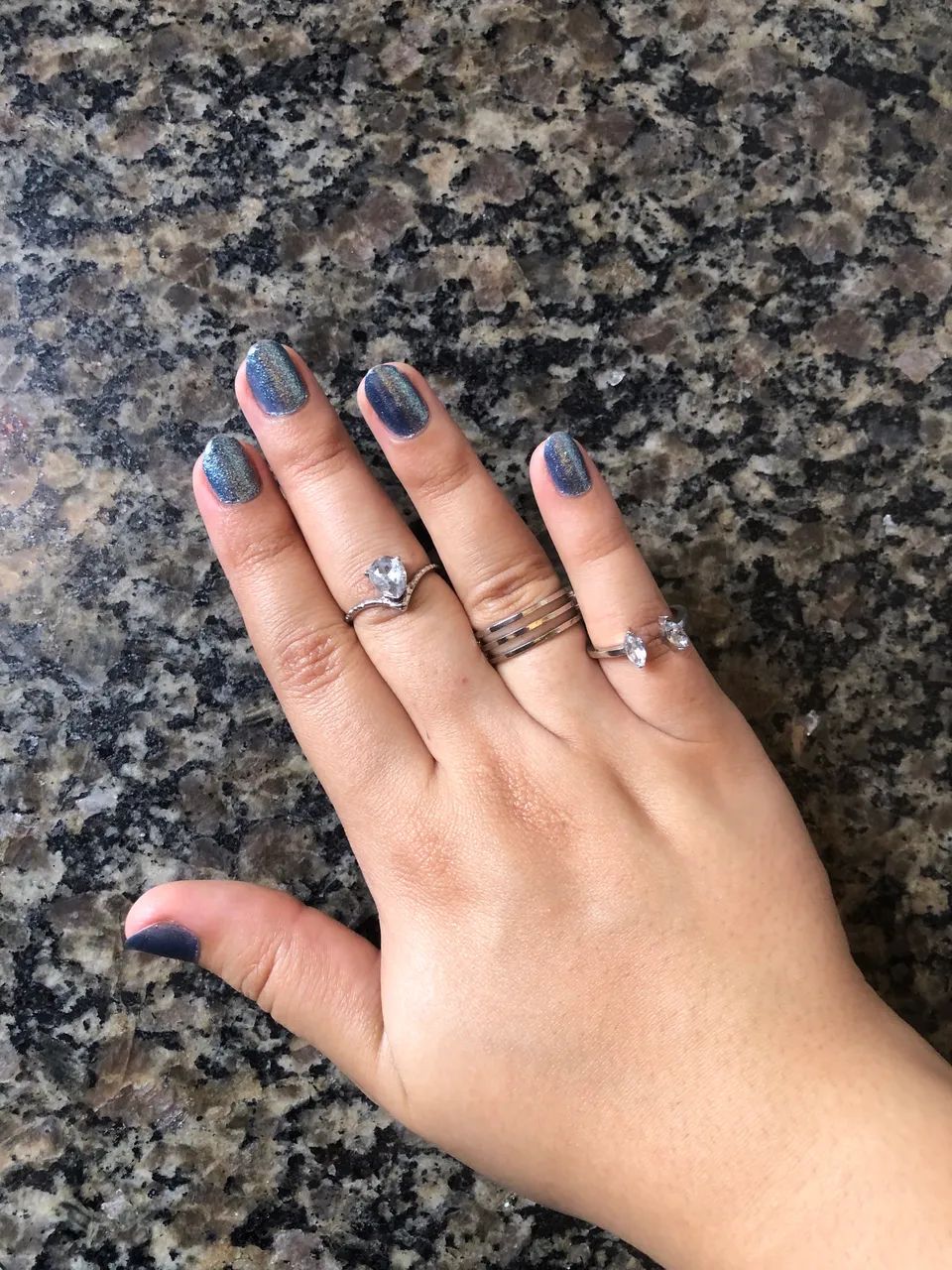 Kit de aneis - Foto 2