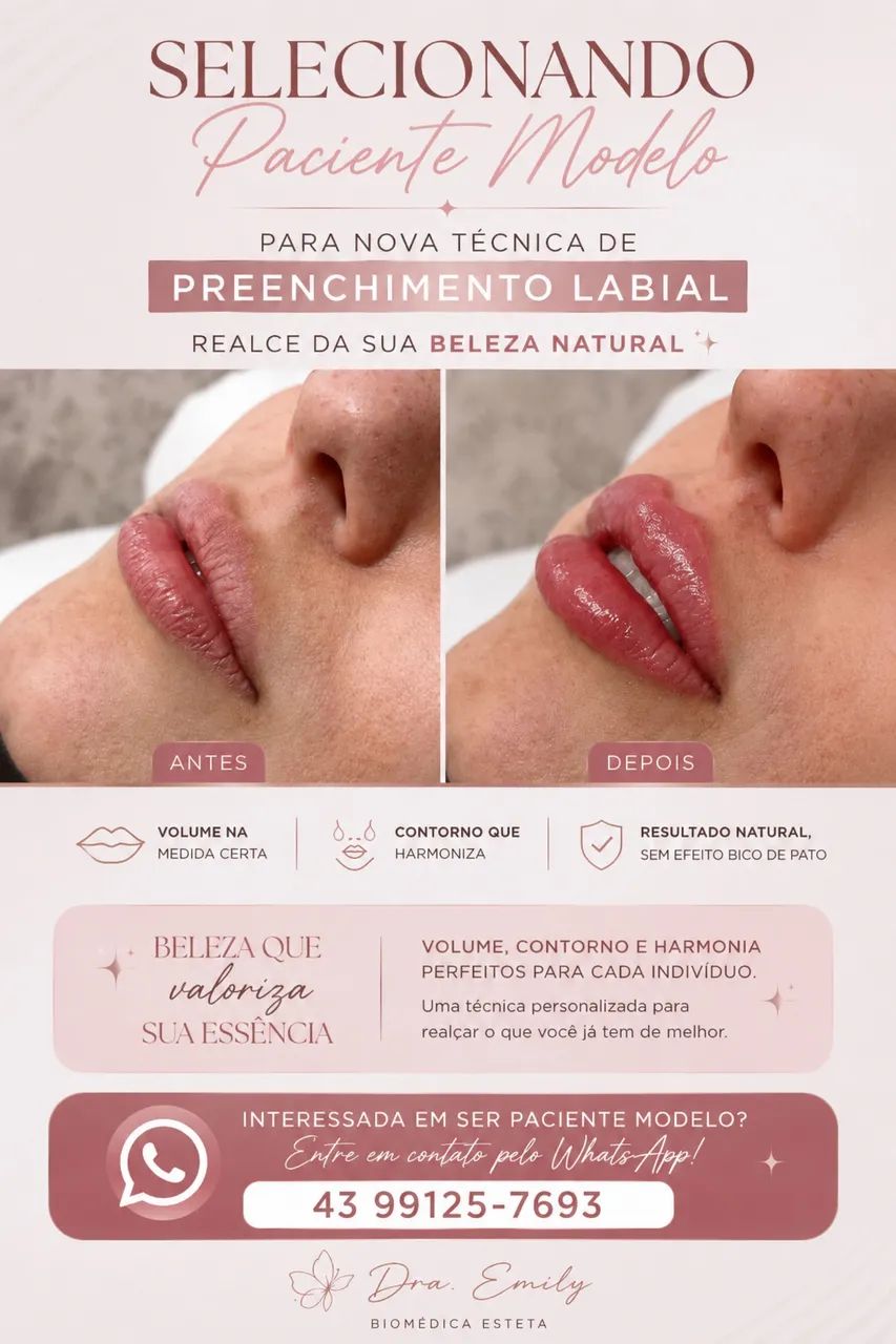 PREENCHIMENTO LABIAL  - Foto 2