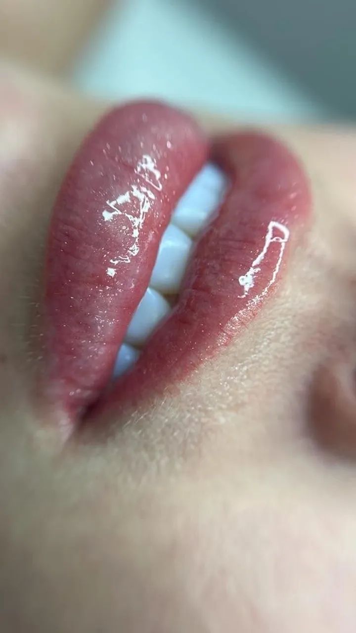 Micropigmentação labial  - Foto 2